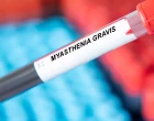 myasthenia gravis