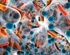 biofilm