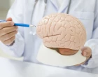 3 vzácná neurologická onemocnění – včasný záchyt a léčba jako klíč k lepšímu osudu nemocných