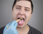 bílý jazyk