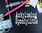 ankylozující spondylitida