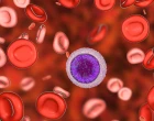 CLL
