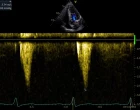 BMS HCM obr. 2