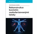 Rekonstrukce končetin vaskularizovanými laloky