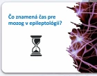 Čas je mozek – název