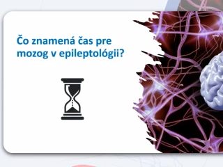 Čas je mozek – název