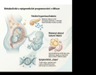 Proč gestační diabetes zvyšuje riziko nadváhy potomka v mladším školním věku náhled