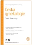 Číslo 1
