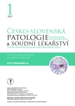 Issue 1
