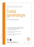 Číslo 2
