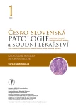 Issue 1