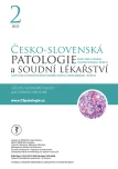 Issue 2