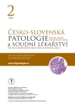 Issue 2