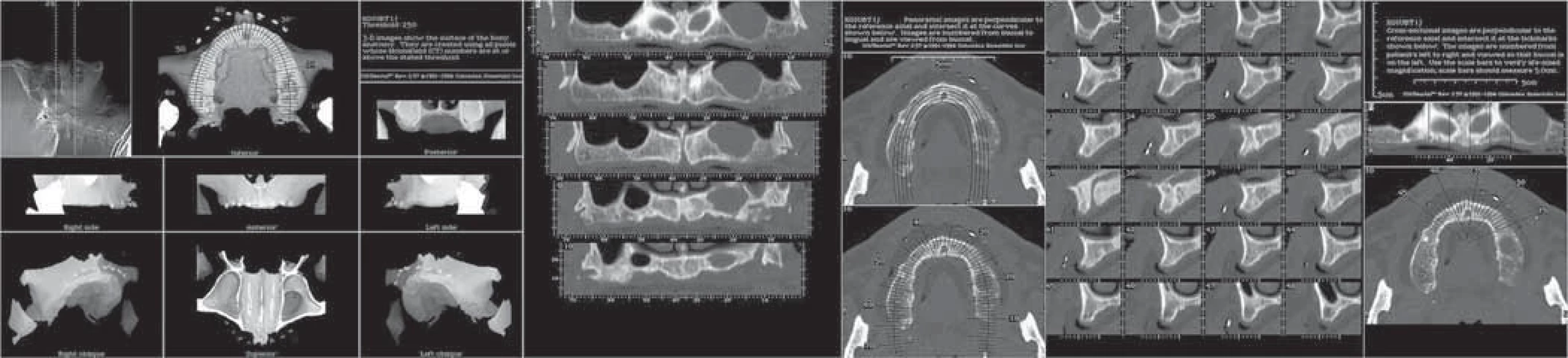3D maxillofacial surgery planning – one decade dev... | proLékaře.cz
