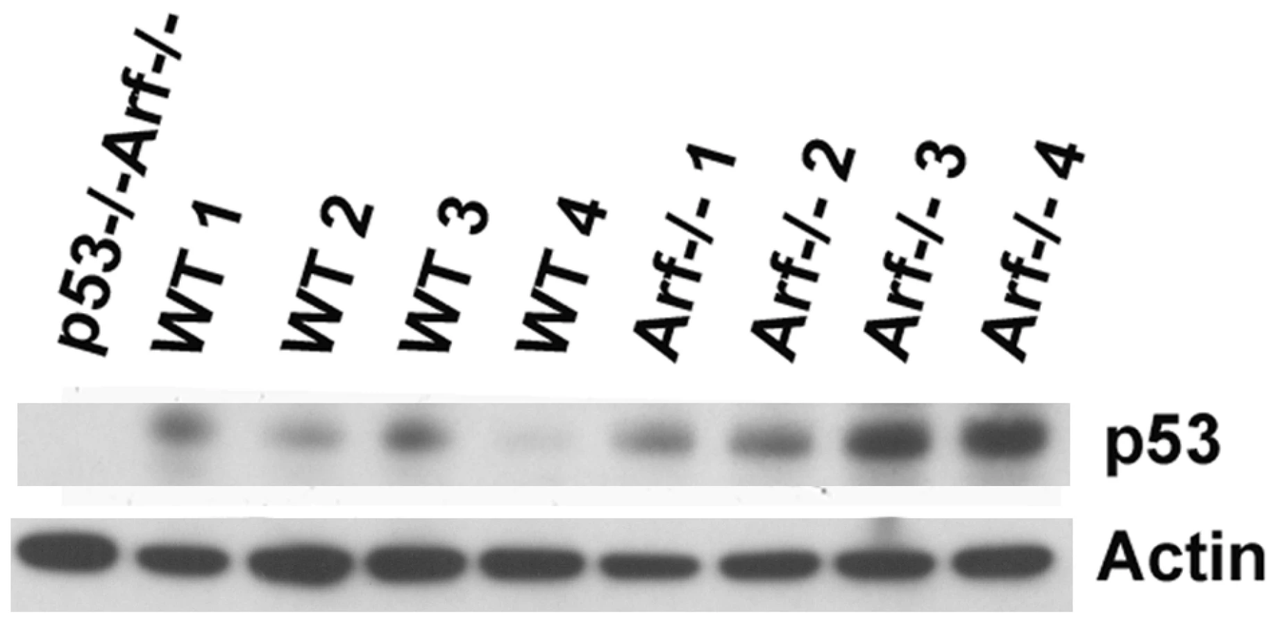 Expression of Tumor Suppressor in Spermatogon... | proLékárníky.cz