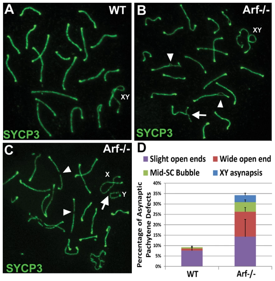Expression of Tumor Suppressor in Spermatogon... | proLékárníky.cz