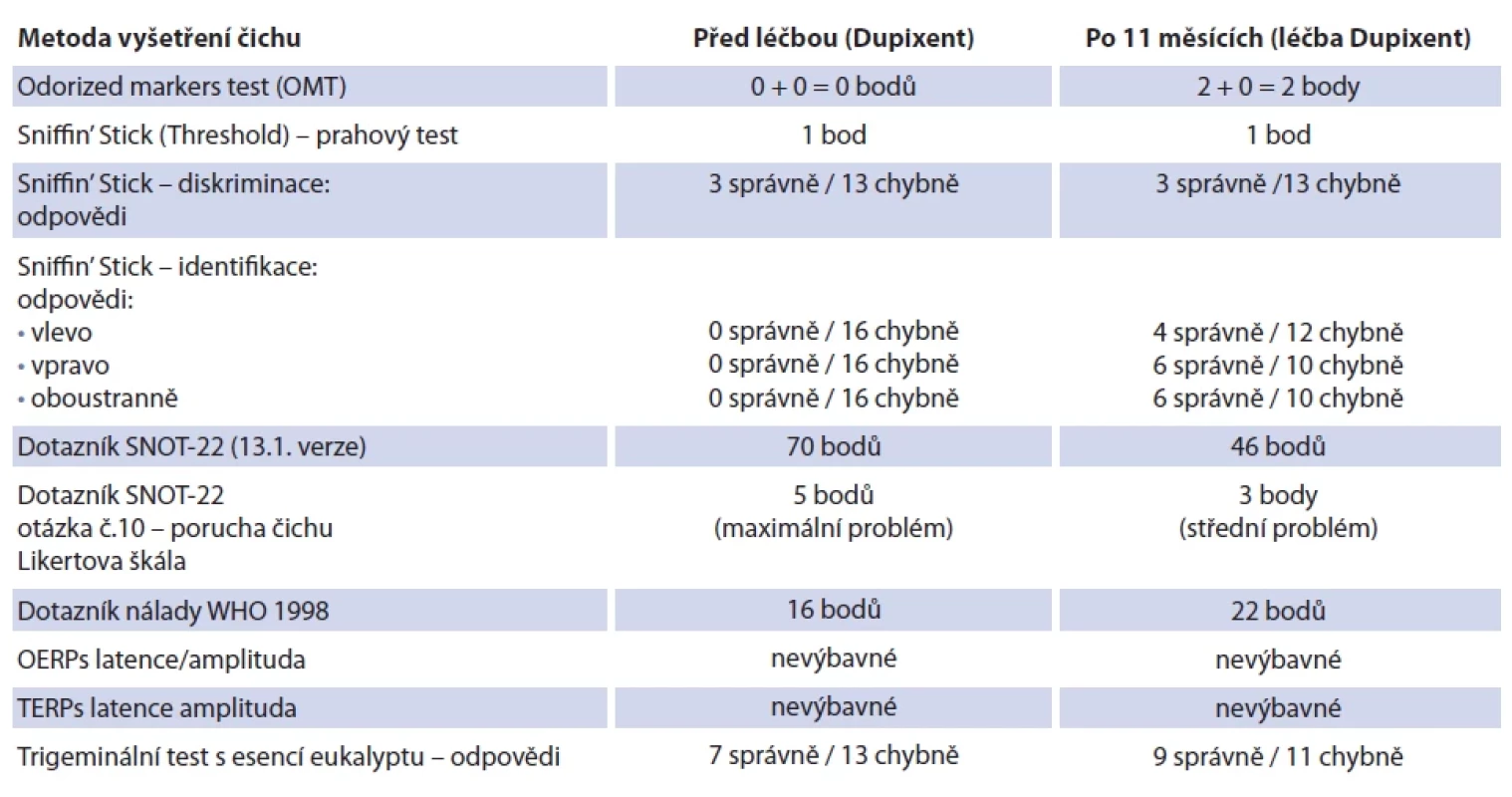 Kazuistika 2: srovnání výsledků čichových testů u subjektu s CRSwNP před/po podání biologické léčby. Tab. 2. Case report 2: comparison of olfactory test results in a subject with CRSwNP before/after biological treatment.