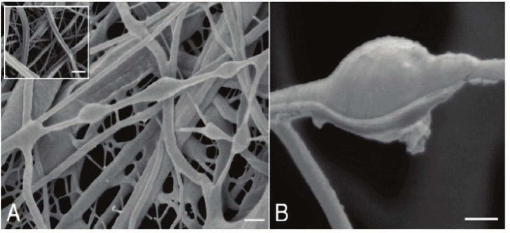Liposomy enkapsulované do PCL/PVA nanovláken pomocí koaxiálního electrospinningu (převzato z [36] se svolením autora).
