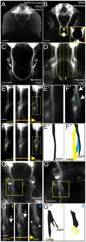 Hypoxia acts during development of the TCPTc by disrupting axon pathfinding.