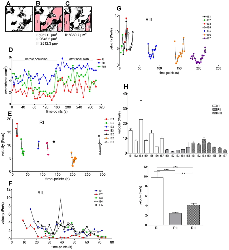 IE accumulation in the labyrinth is favored in regions of low blood flow.