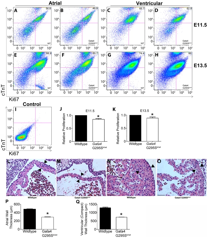 Proliferation deficits in <i>Gata4 G295S<sup>ki/wt</sup></i> embryonic cardiomyocytes.