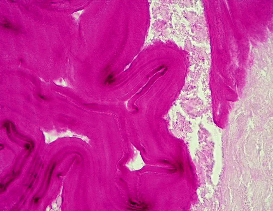 Histologický obraz – PAS pozitivní membrána parazita