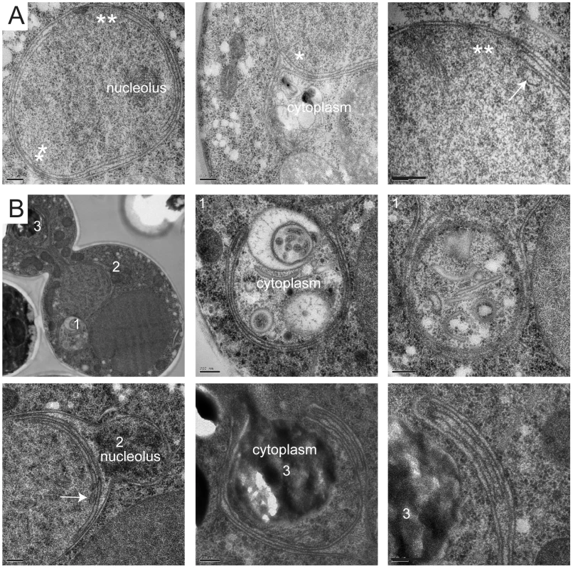 Formation of tubules and intranuclear membranes in <i>MPS3-G186K</i> cells.