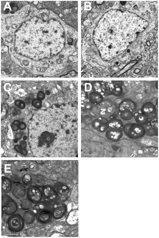 Electron micrographs of mouse brain tissues.