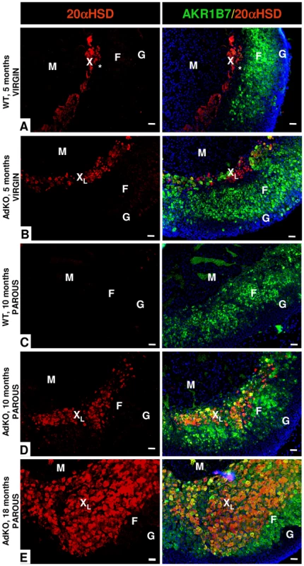 Existence of a persistent, mislocated X-like-zone in AdKO adrenals.