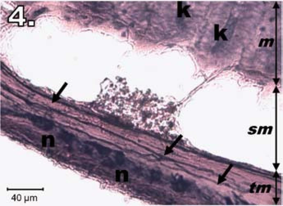 Histologický obraz jejuna v skupine R30. n – NADPH-d pozitívne neuróny opäť silne pozitívne, šípky – nervové vlákna silne pozitívne, k – Lieberkühnove krypty pozitívne, m – mukóza, sm – submukóza, tm – tunica muscularis; scale bar = 40 μm
Fig. 4. Histological picture of jejunum in group R30. n – neurons fully NADPH-d positive, arrows – positive nerve fibres, k – positivity in Lieberkühn's crypts, m – mucosa, sm – submucosal layer, tm – tunica muscularis; scale bar = 40 μm