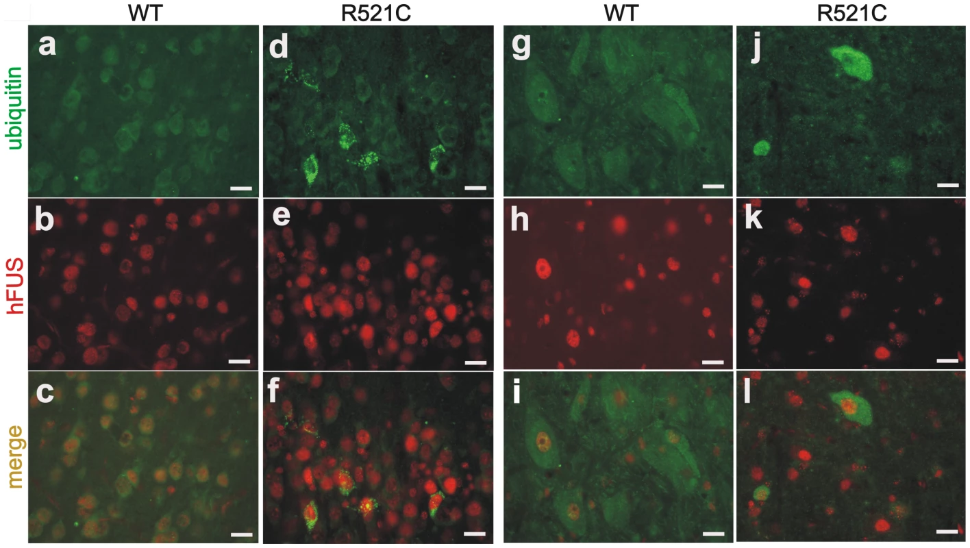 Accumulation of ubiquitin in mutant FUS transgenic rats.