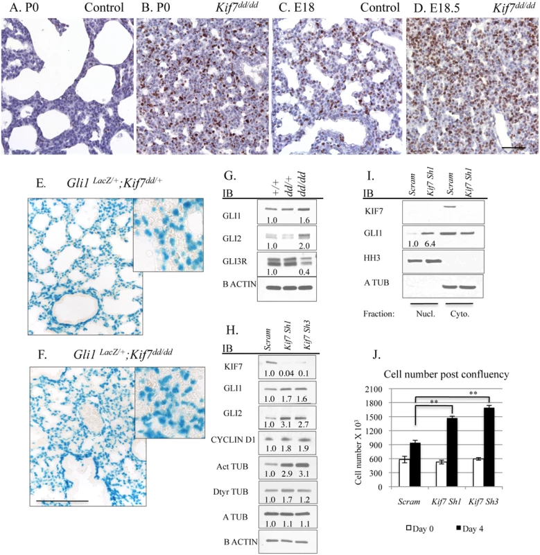 KIF7 Regulates <i>Hh</i> Signaling, Cell density, and Cell cycle Exit in Fibroblasts Within the Neonatal Lung.