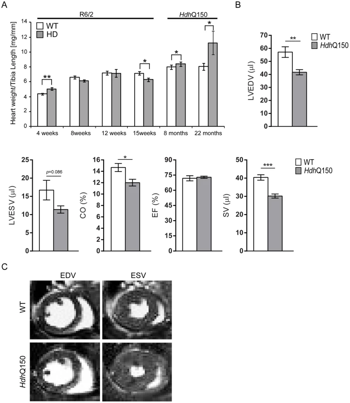 Morphometric and MRI analysis of HD mouse model hearts.