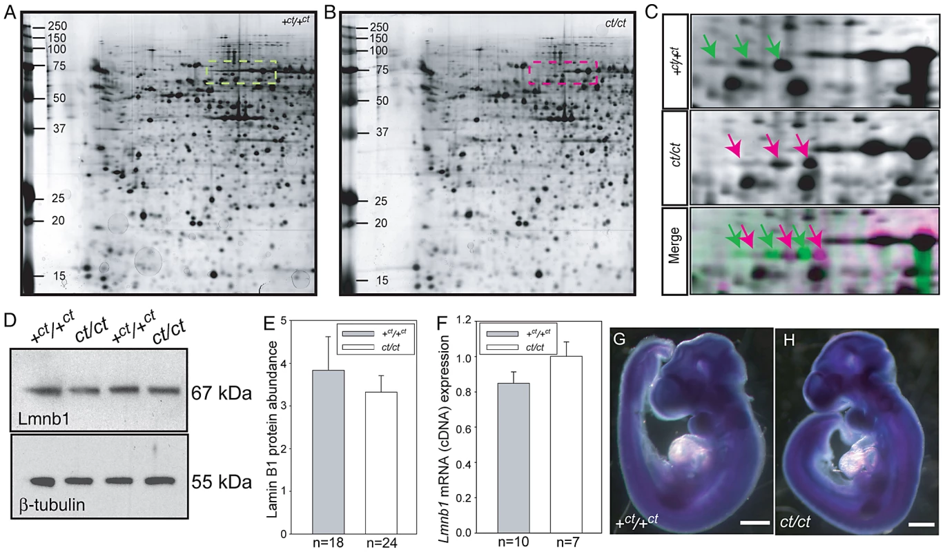 Lamin B1 shows differential protein migration by two-dimensional gel electrophoresis in <i>curly tail</i> and wild-type embryo samples.