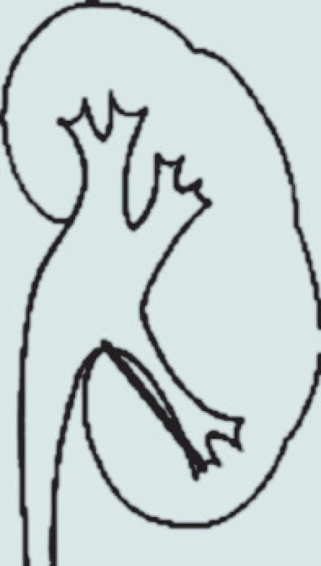 Měření anatomie dolního kalichu.