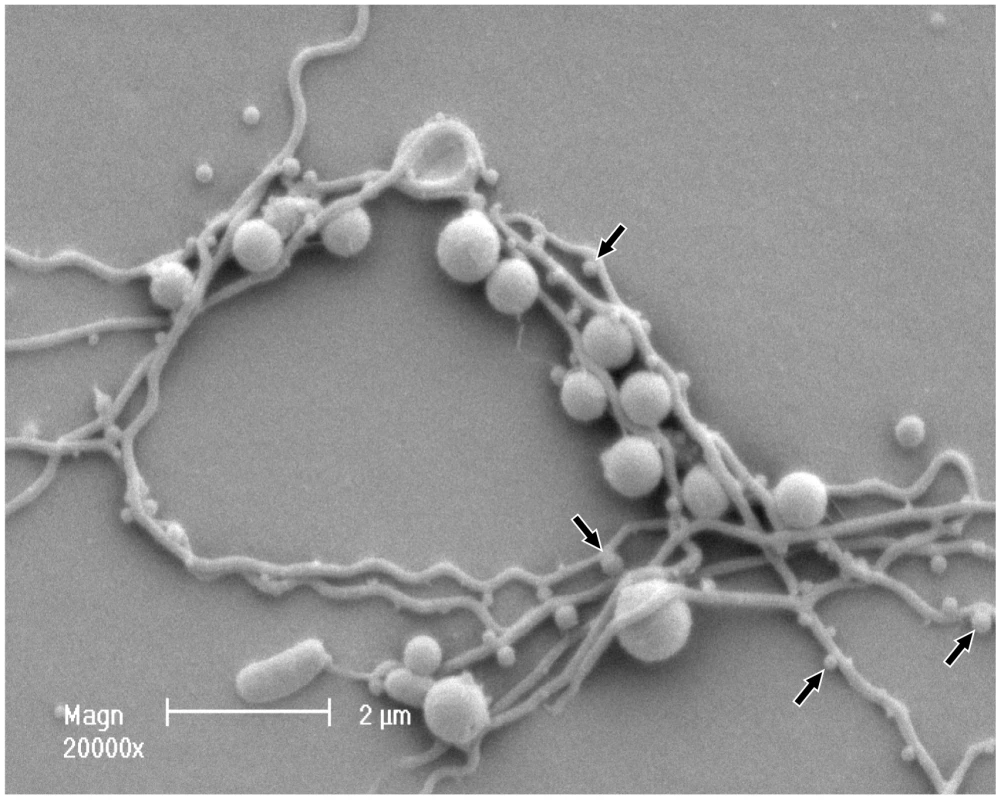 Scanning electron micrograph of <i>P. gingivalis</i> and <i>T. denticola</i> grown in continuous culture.