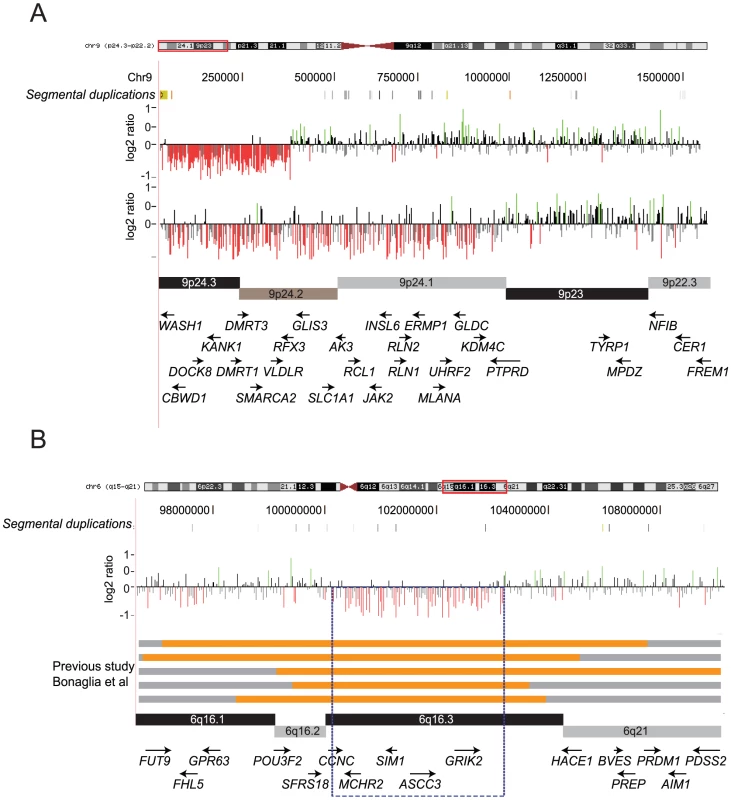 Novel CNVs identified in the ID cohort.
