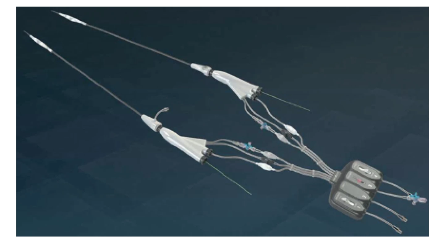 Ovládací konzole (vpravo) se zaváděcími systémy obou stentgraftů Nellix (vlevo)
Fig. 1: Nellix console (right) and stent graft delivery systems (left)

