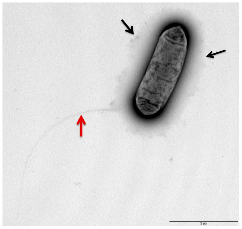 Electron microscopy showing the presence of capsule like structures.