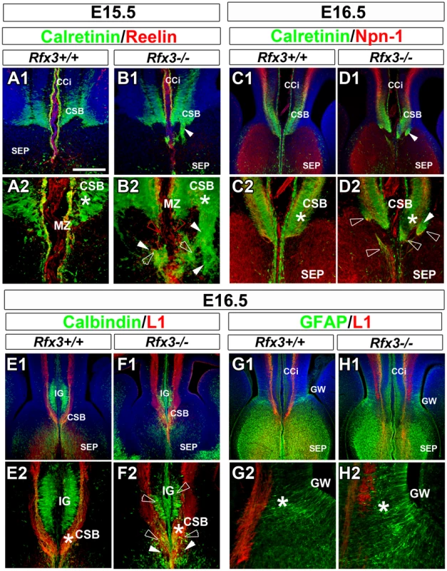 Abnormal neuron localization and aberrant callosal axon pathfinding at the onset of CC formation.