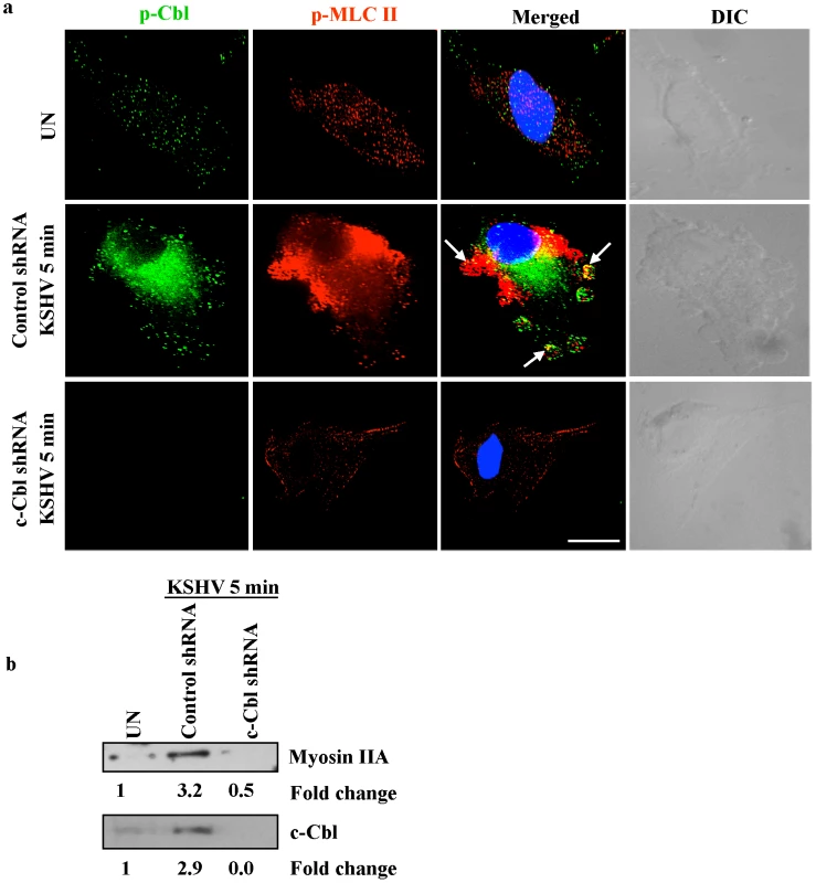 c-Cbl recruits myosin IIA to the membrane blebs.