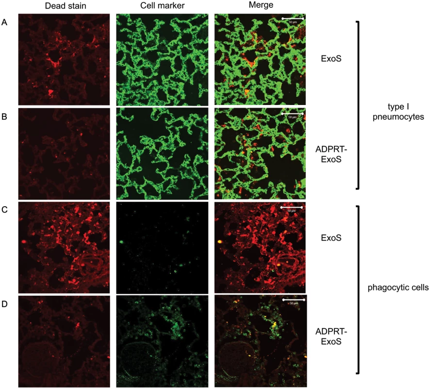 FOCI injected with ExoS contain many dead type I pneumocytes, whereas FOCI injected with ADPRT-deficient ExoS contain only a few dead phagocytic cells.