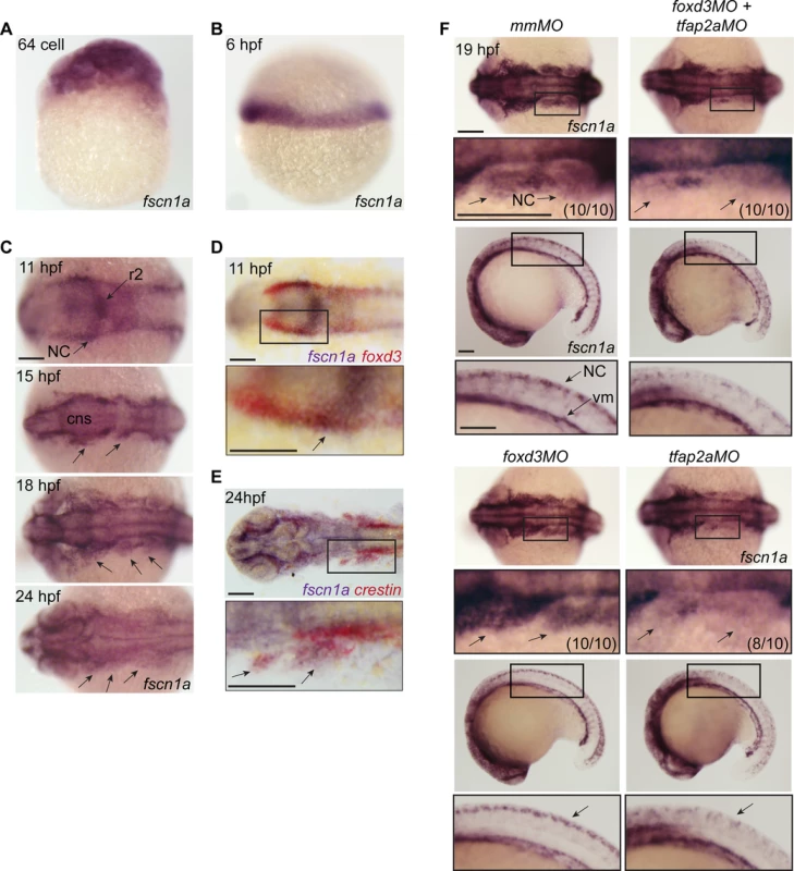 <i>fscn1a</i> mRNA expression in zebrafish NC is regulated by <i>tfap2a</i>.
