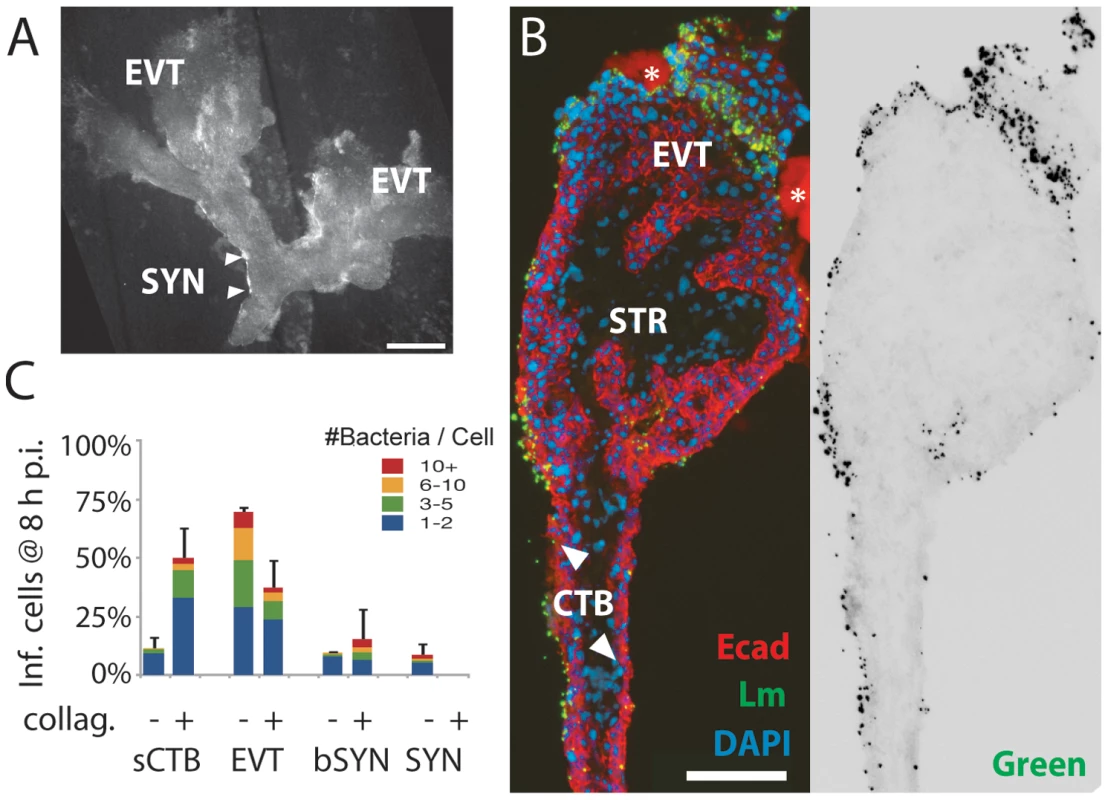 <i>L. monocytogenes</i> infects villous cytotrophoblasts when syncytiotrophoblast is removed.