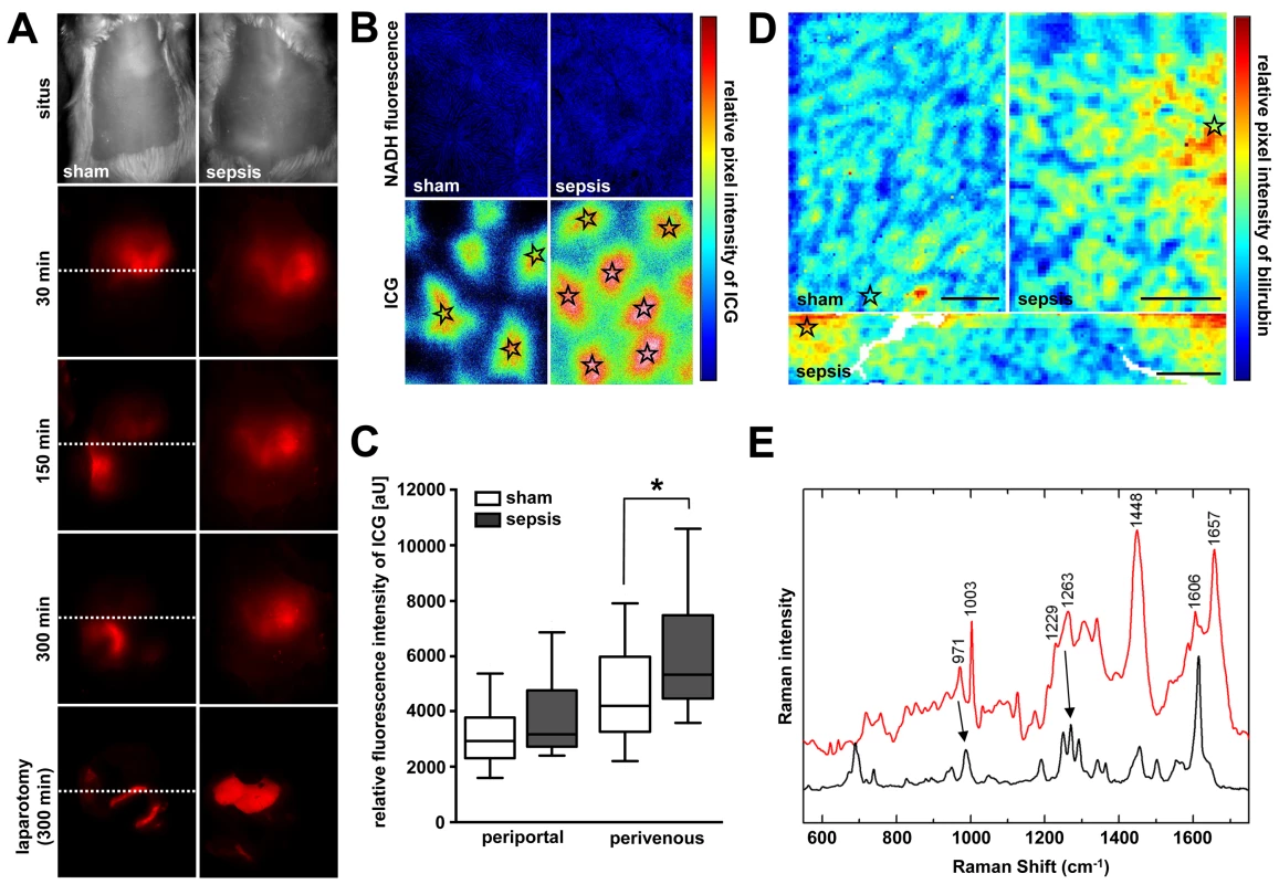 Sepsis-induced excretory dysfunction, as visualised by accumulation of the xenobiotic indocyanine green and bilirubin.