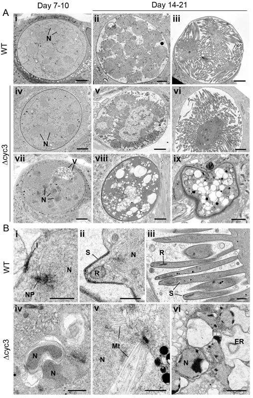 Ultrastructure analysis of oocyst development in <i>∆cyc3 mutant</i>.