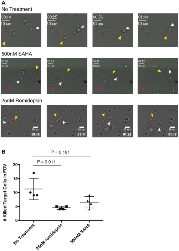 Time-lapse microscopy of CTL killing of peptide pulsed BLCL target cells in 3D collagen matrices.
