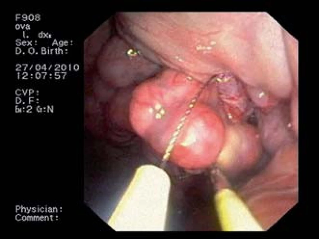 NOTES experimentální ovarektomie.
Fig. 6. NOTES experimental ovariectomy.