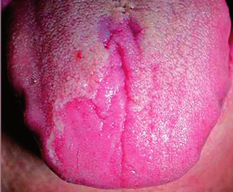 Lingua geographica
