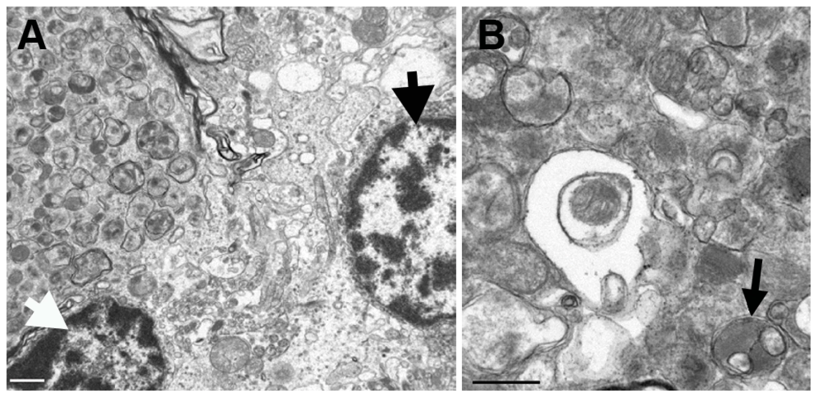 Transmission electron micrographs of the cerebellum of an affected Gordon Setter.